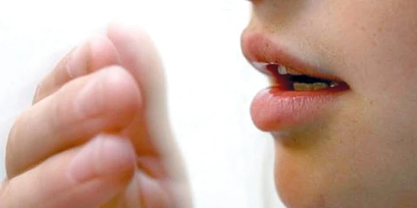 أسباب رائحة الفم الكريهة والتخلص منها بالمنزل 2 رائحة الفم الكريهة