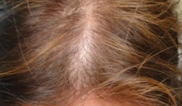 نمو الشعر وأسباب وعلاج التقصف 4 نمو الشعر