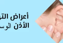 أعراض التهاب الأذن للأطفال والبالغين