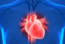 تشخيص النوبة القلبية علاجها خطوات الوقاية من نوبة القلب