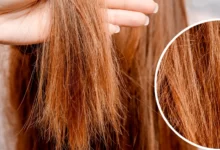 5 حلول نهائية لعلاج تساقط الشعر 26 علاج تساقط الشعر