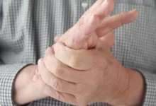 ما هي أسباب تنميل اليدين ال8 ؟ 22 تنميل اليدين2