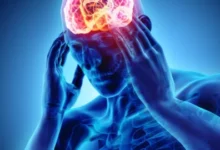 أسباب الصداع في مقدمة الرأس 24 أسباب الصداع في مقدمة الرأس وأنواعه