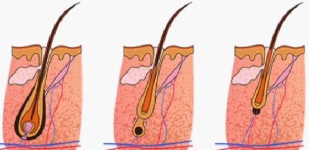 نمو الشعر وأسباب وعلاج التقصف 1 نمو الشعر