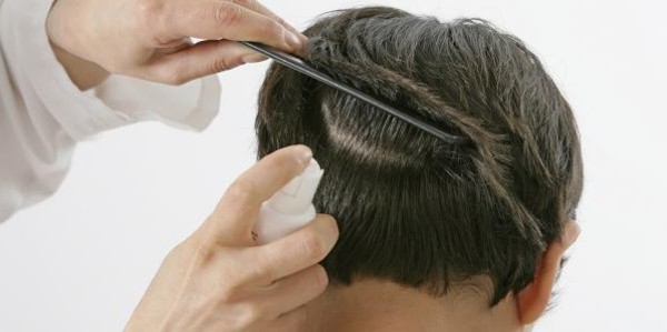 علاج القمل والصيبان في شعر الرأس والإبط