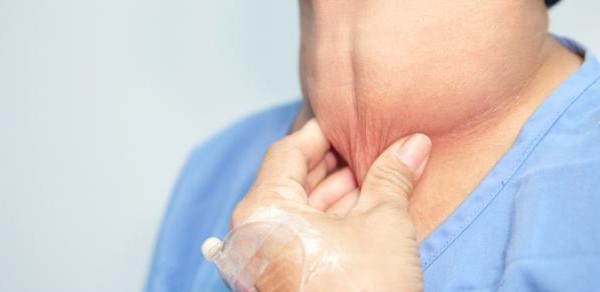 أسباب وأعراض فرط نشاط الغدة الدرقية ومضاعفاتها 3 الأسباب والأعراض | فرط نشاط الغده الدرقية ومضاعفاتها