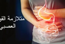 أعراض وأسباب متلازمة القولون العصبي 29 متلازمة القولون العصبي