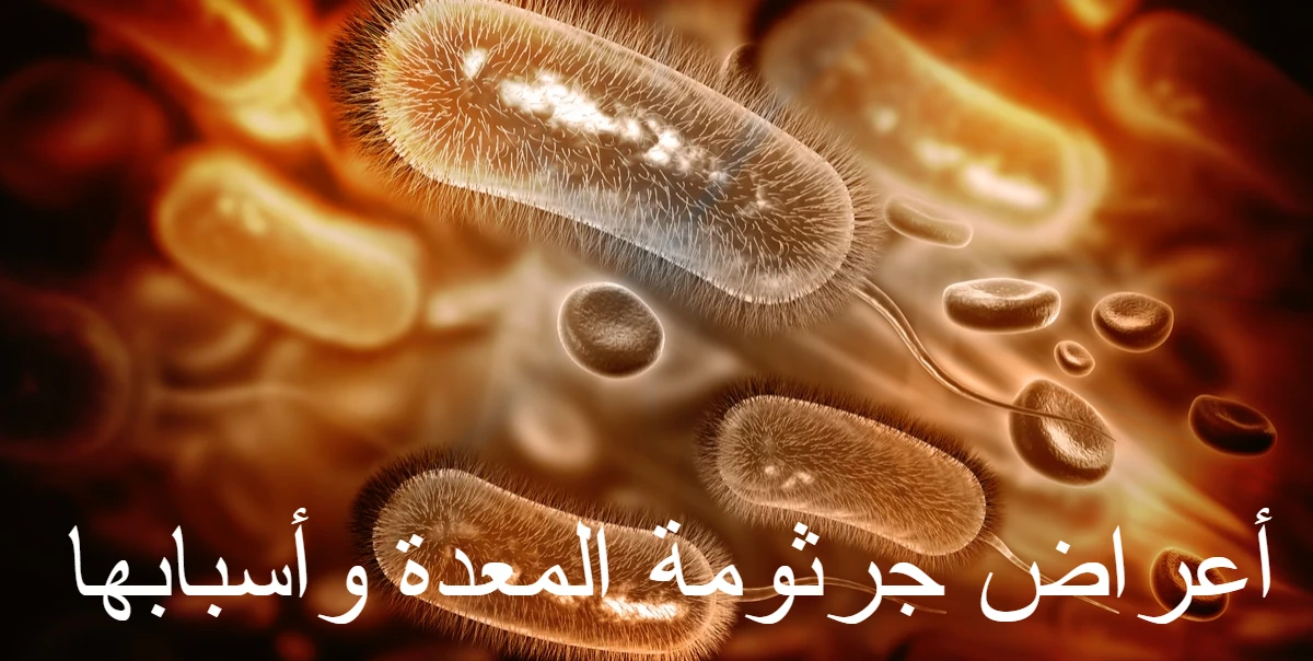 أعراض جرثومة المعدة وأسبابها 1 أعراض جرثومة المعدة وأسبابها