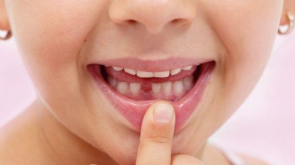 6 أسباب لتساقط الأسنان وكيفية الحفاظ عليها