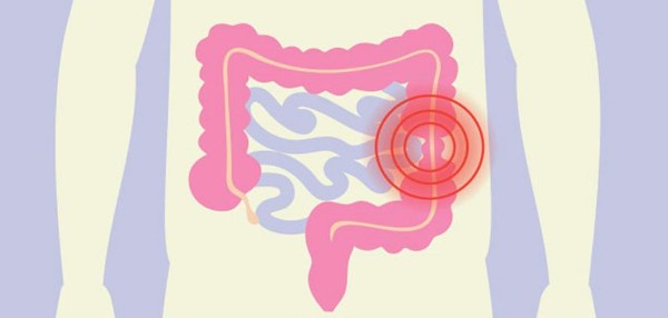 علاج القولون العصبي والوقاية منه و 4 مشروبات لعلاجه 3 علاج القولون العصبي