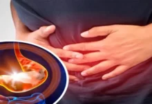 أمراض المعدة وأشهر أسبابها وعلاج كل سبب منهم 24 أمراض المعدة
