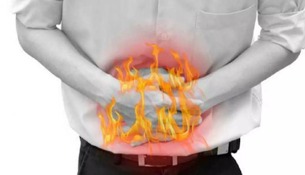 8 أسباب تصيبك بحموضة المعدة 1 حموضة المعدة