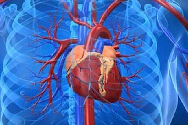 أسباب مرض القلب 3 أسباب مرض القلب