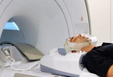 اوسبيلدونغ فني الأشعة و 4 متطلبات للمهنة 21 اوسبيلدونغ فني الأشعة