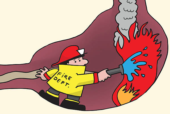 8 أسباب تصيبك بحموضة المعدة 2 حموضة المعدة