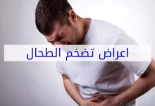 8 أعراض لمرض تضخم الطحال وطرق علاجه 25 تضخم الطحال