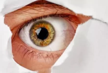 4 أسباب لمرض ويلسون وطرق العلاج 26 مرض ويلسون