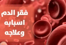 مرض فقر الدم