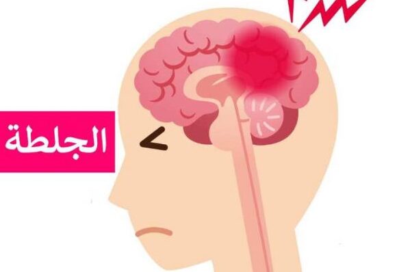 السكتة الدماغية و 14 سبب يصيبك بها 3 السكتة الدماغية