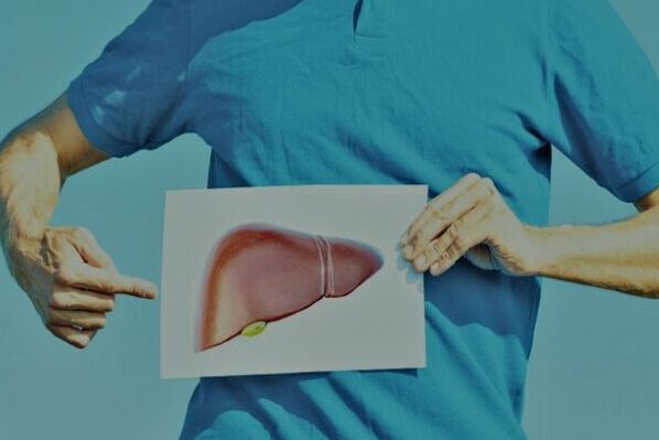 10 أسباب تؤدي إلى مرض تشمع الكبد 4 مرض تشمع الكبد