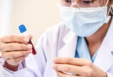 معلومات عن أوسبيلدونغ التحاليل الطبية في المانيا 21 أوسبيلدونغ التحاليل الطبية