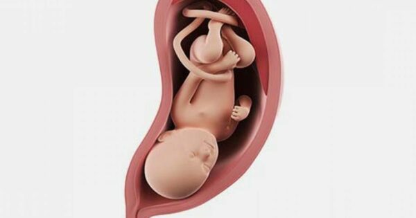 اذا نزل رأس الجنين في الحوض متى اولد