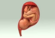 اذا نزل رأس الجنين في الحوض متى اولد 31 اذا نزل رأس الجنين في الحوض متى اولد