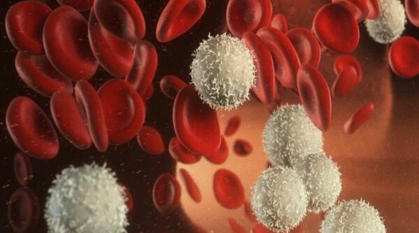 اللوكيميا مرض يصيب خلايا الدم الحمراء صح ام خطأ ؟