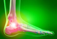 هل ألم باطن القدم له علاقة بالرحم 21 هل ألم باطن القدم له علاقة بالرحم