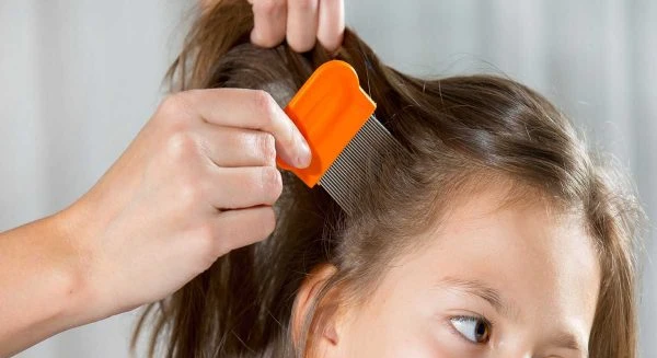 شامبو كلاينز لعلاج القمل نهائيا 4 شامبو كلاينز لعلاج القمل