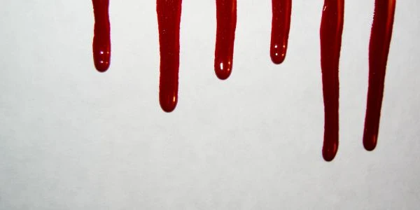 تفسير حلم الدم في الحلم 2 الدم في الحلم