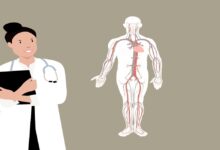 افضل طبيب اعصاب في ارفورت 25 طبيب اعصاب في ارفورت