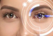 افضل طبيب عربي عيون في المانيا 24 افضل طبيب عربي عيون في المانيا