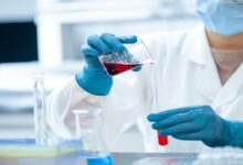 افضل طبيب مسالك بولية عربي في أوبرهاوزن 27 طبيب مسالك بولية عربي في أوبرهاوزن