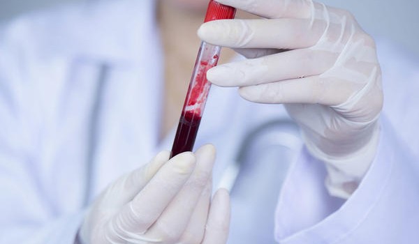 كيف أعرف فصيلة دمي دون تحليل